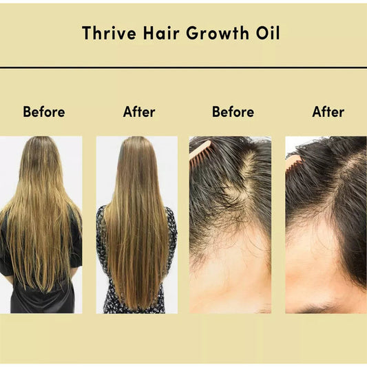 Natural Hair Growth Serum & Thrive Hair Oil